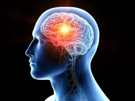 RCSI discovery may lead to better treatments for brain cancer