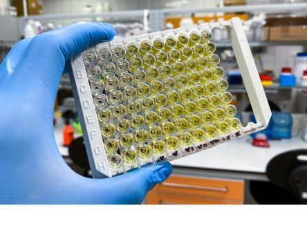 Galway researchers make healthcare breakthroughs with biomarkers research