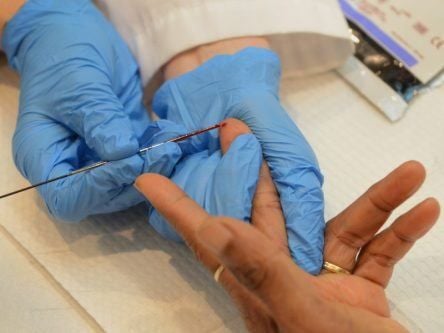 RCSI discovery could lead to new treatments for blood clotting disorders