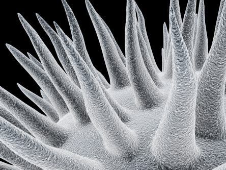 UCD-led project secures €2.5m to enhance biomedical imaging