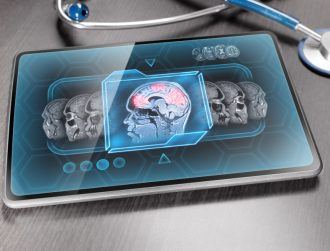 Scientists claim AI-based decoder can translate thoughts into text